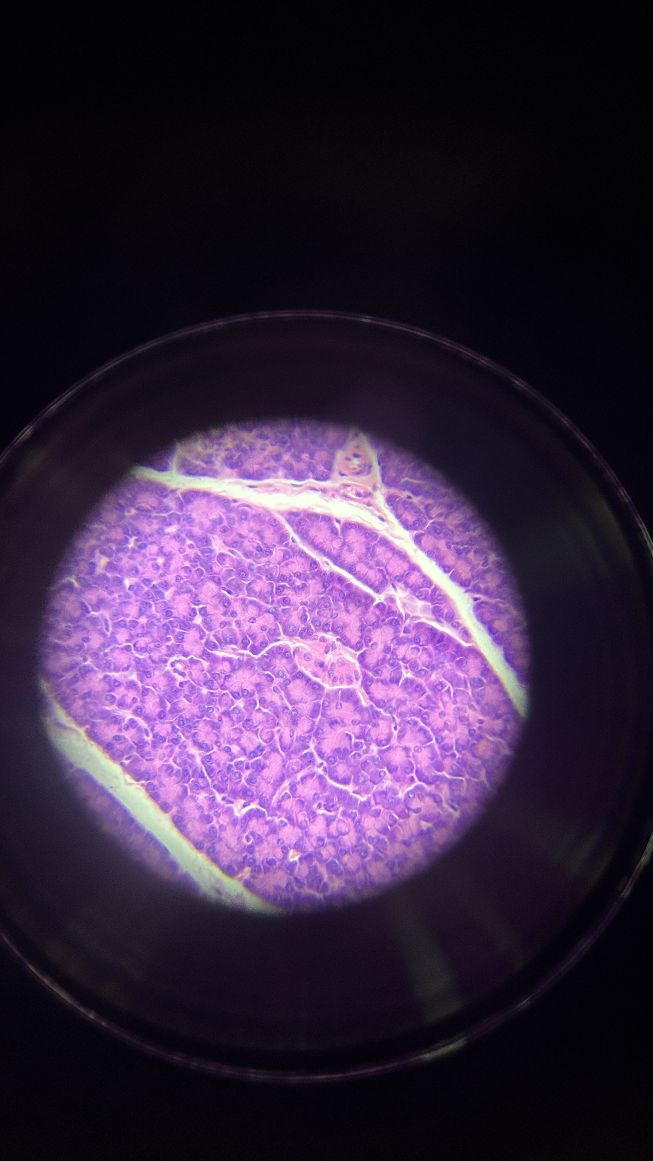 <p>What is the magnification level of the Reticular CT?</p>