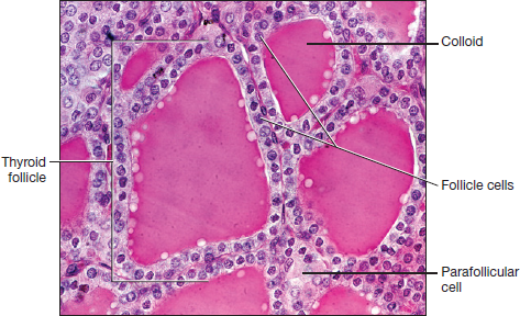 <p>What type of histology slide is this showing and how do you know</p>
