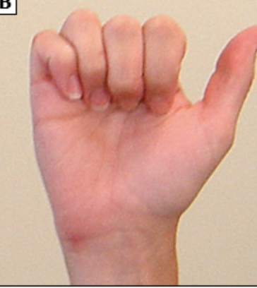 <p>Straightening your fingers out, for instance, to catch a ball.</p>
