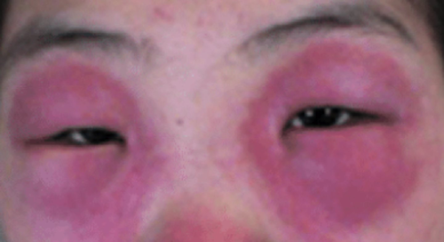 <p>What is the diagnosis?</p>
