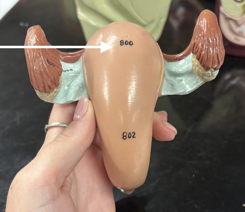<p>what structure is the arrow pointing to? </p>