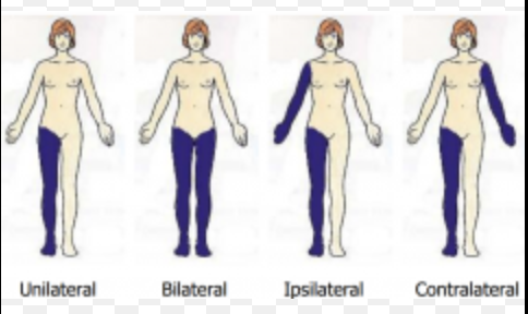 <p>contralateral - opposite side</p><p>ipsilateral - same side </p>