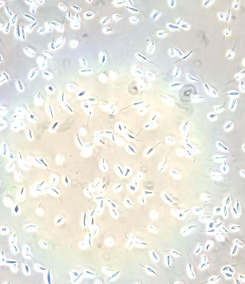 <p>What are these parasites?</p>
