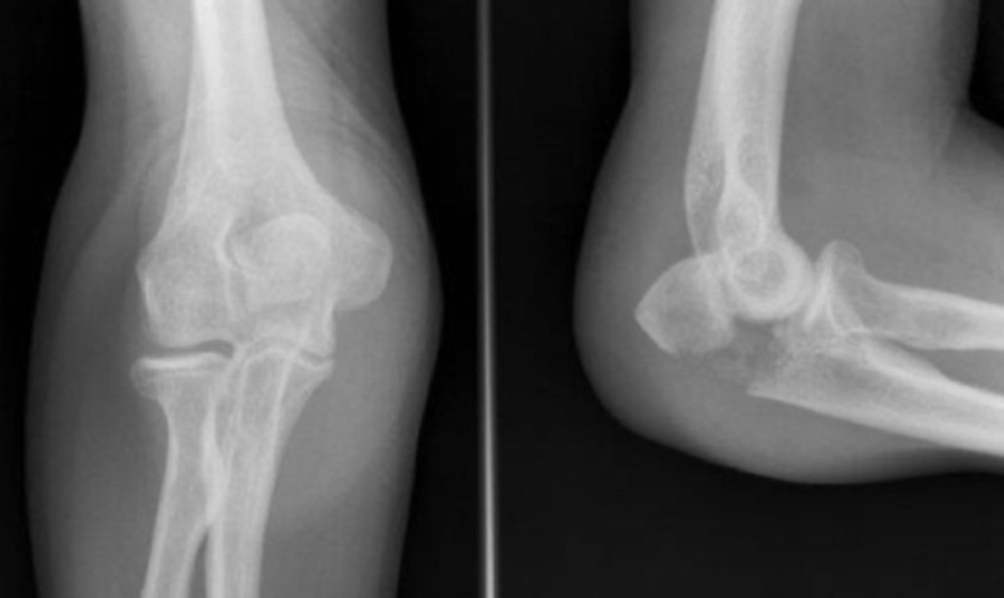 <p>What is the issue?</p>