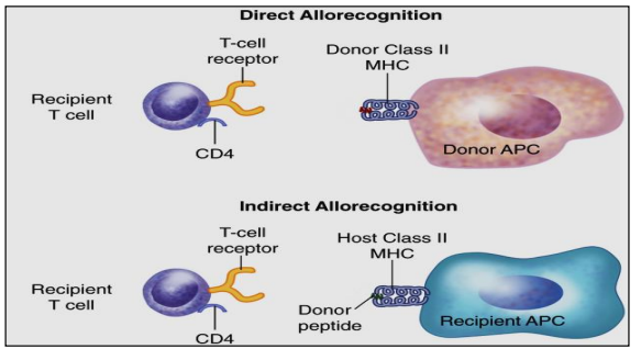 <p>DONOR antigen presenting cells (APCs) migrate out of allograft tissue and present DONOR antigen through donor APC surface MHC-II molecules to the recipient’s CD4+ T cells (donor-recipient).<br></p>