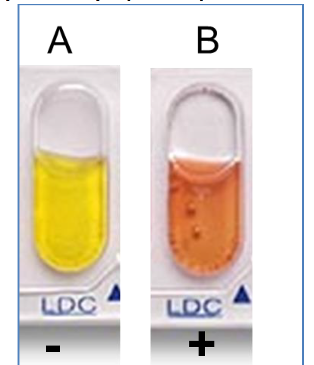 <p>Lysine Decarboxylase </p><p>Determine whether bacteria can decarboxylate lysine by Lysine decarboxylase.</p>