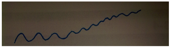 <p>Air trapping</p><p><em>expiration; barrel-chested</em></p>