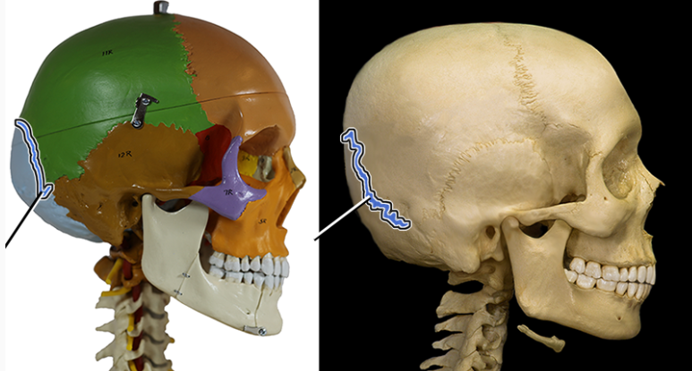 <p>connects the parietal bones with the occipital bone.</p>