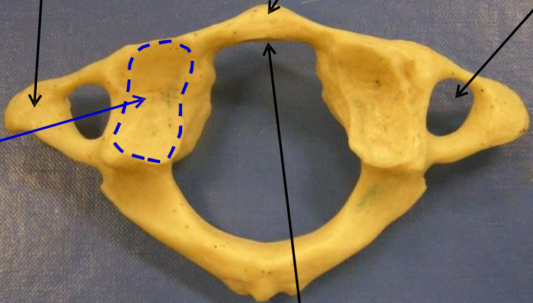 <p>Name the vertebra.</p>