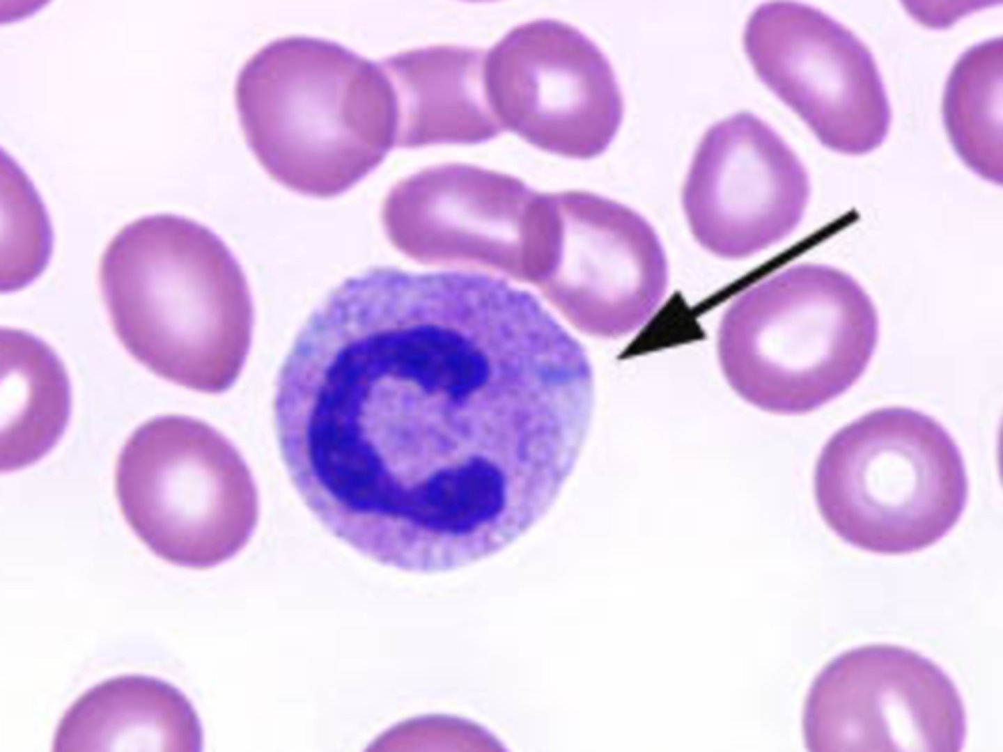 <p>- Gray-blue, variable-shaped inclusions in cytoplasm</p>