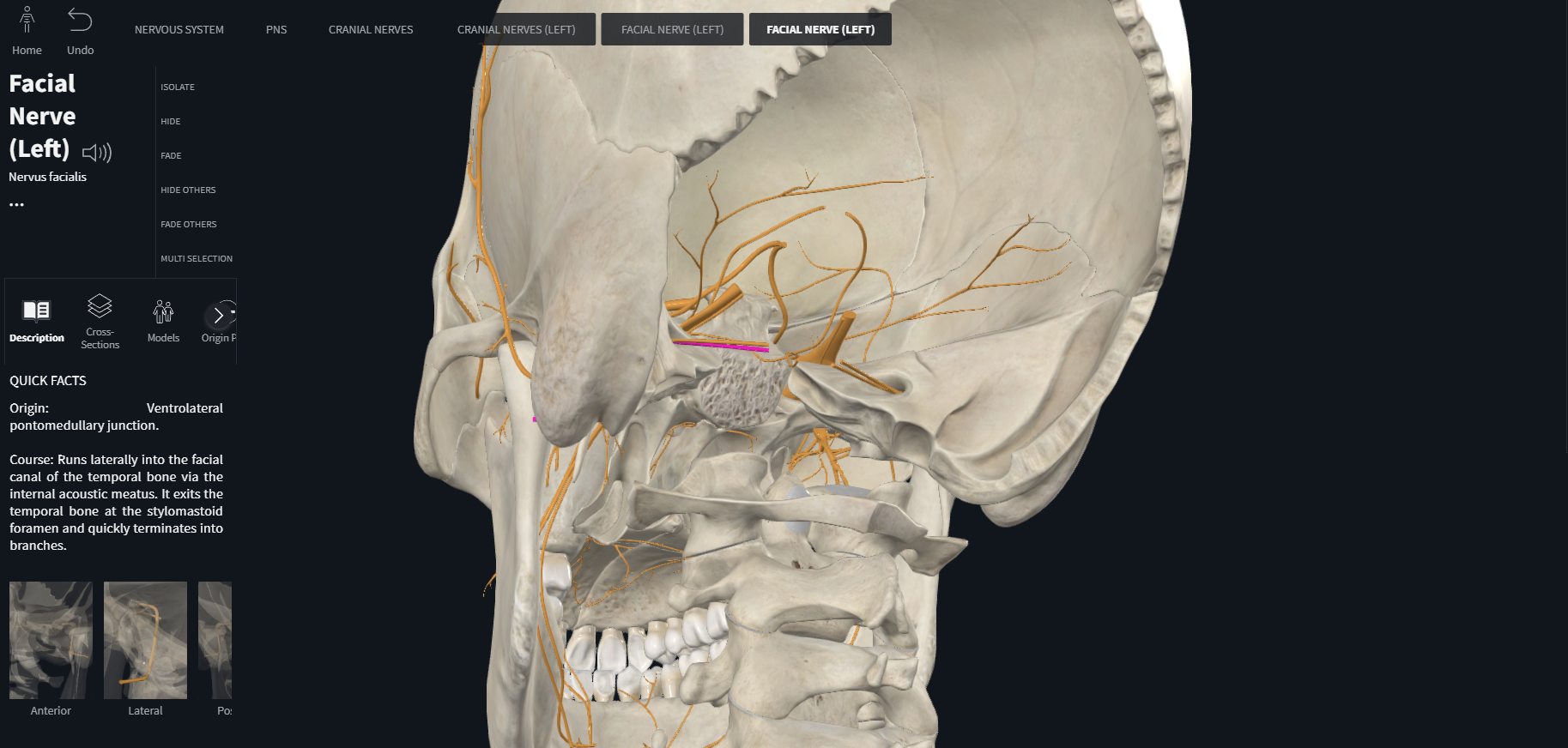 <p>Facial (VII)<br>part of central nervous system from which nerve enters or emerges</p><p>general function types of fibers</p><p>general distribution</p>