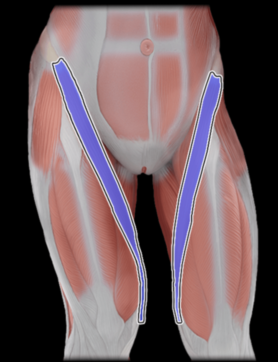 <p>What Muscle Is Highlighted?</p>