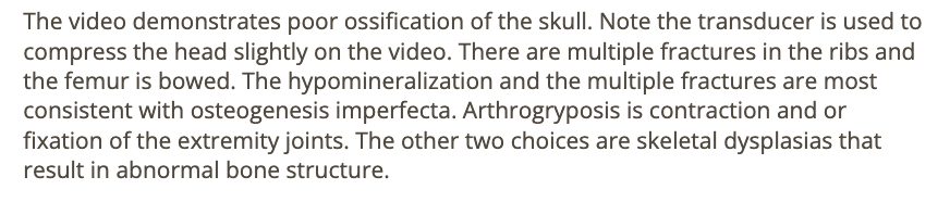 <p>a) osteogenesis imperfecta</p>