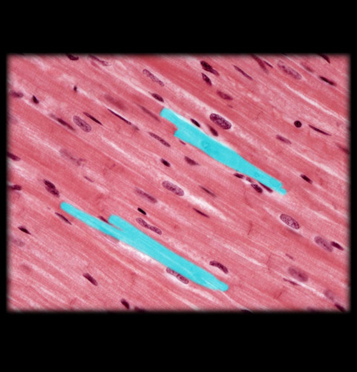 <p>•involuntary, striated muscle</p><p>•In the heart</p>