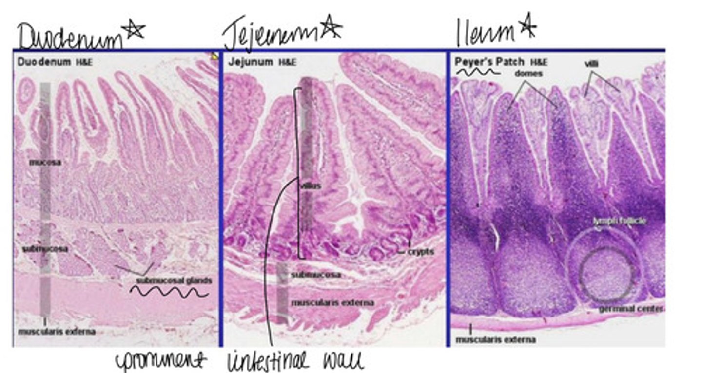 <p>Duodenum: duodenal glands</p><p>Jejunum: prominent intestinal villi</p><p>Ileum: peyer's patches</p>