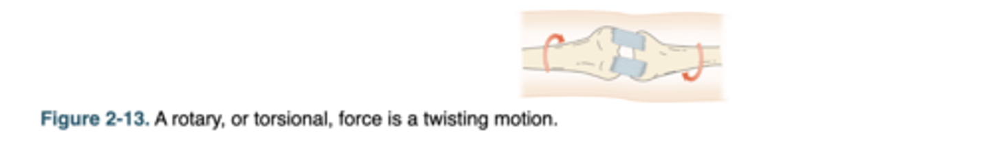 <p>are opposing forces creating twisting within an object, which can result in spiral fractures in bones like the tibia.</p>