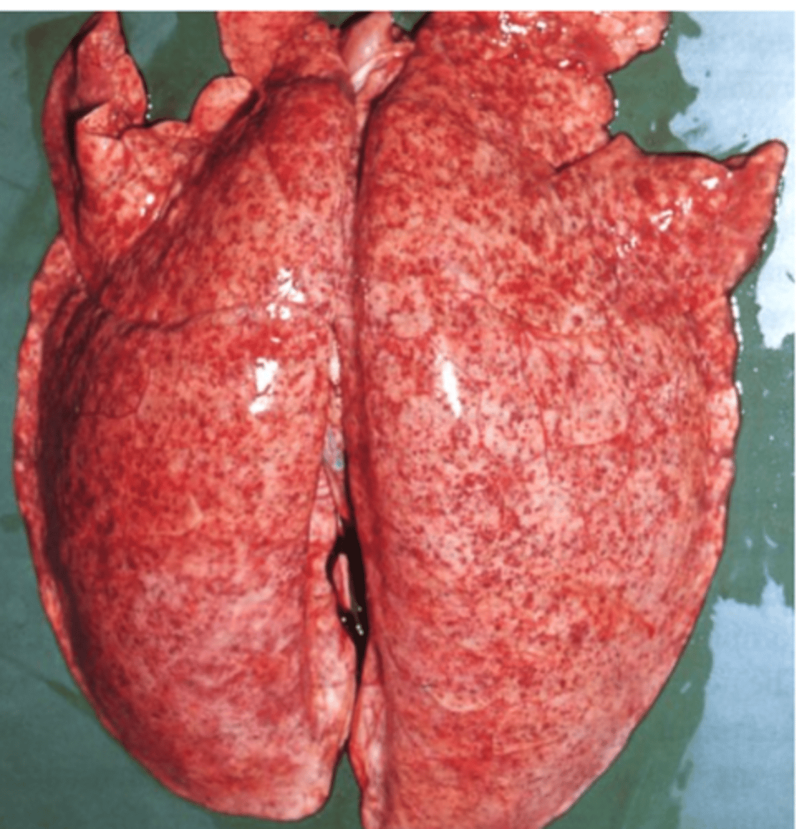<p>Larvae may produce lesions in the liver (milk/white spots) and lungs;</p><p>Adult worms cause lesions in the digestive tract;</p><p>Liver: milk/white spots (larvae) = Cloudy/whitish spots up to 5 mm in diameter on the surface of liver</p><p>Small hemorrhages into the alveoli and bronchioles,oedemainfiltrationof the surrounding pulmonary parenchyma with eosinophils and other cells  lungs compromised by these lesions become more susceptible to other conditions</p><p>Small intestine (adult worms)</p><p>Compete with the host for nutrients  retard growth;</p><p>Heavy infections → may block the gut;</p><p>Perforate the intestine  peritonitis;</p>