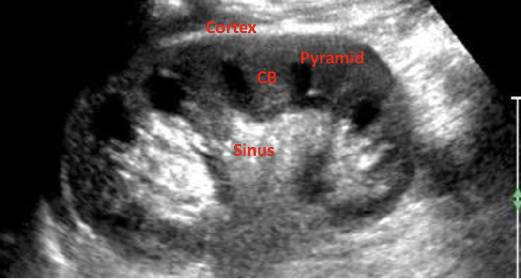 <p>What does CB stand for in this image?</p>