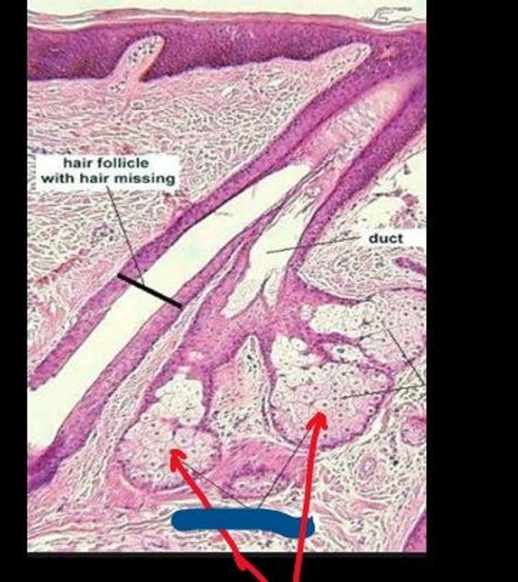 <p>What structure is indicated by red arrow?</p>