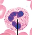<p>what type of blood cell is this?</p>