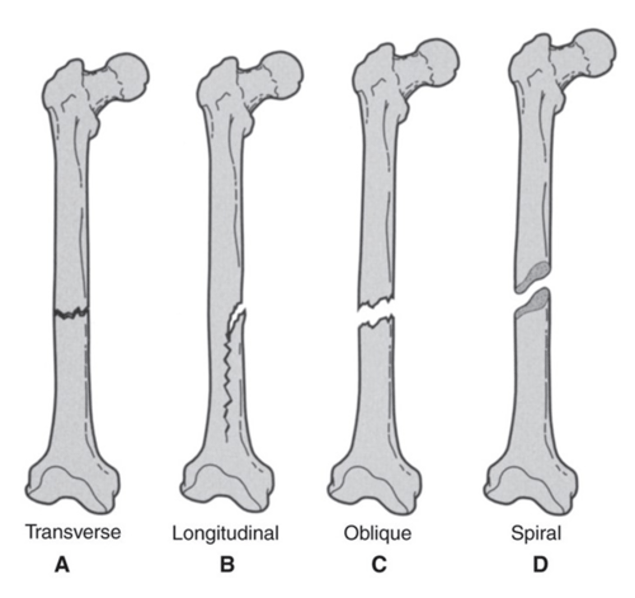 <p>Longitudinal</p>