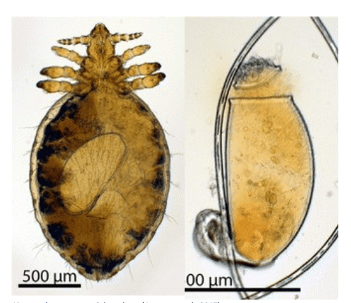 <p>Head</p><p>Narrower than the thorax;</p><p>Legs: first pair smaller than the 2nd and 3rd pairs,</p><p>Feeding: blood;</p>