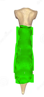 term image
