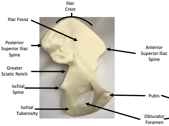 <p>What view of the Os Coxae is this?</p>