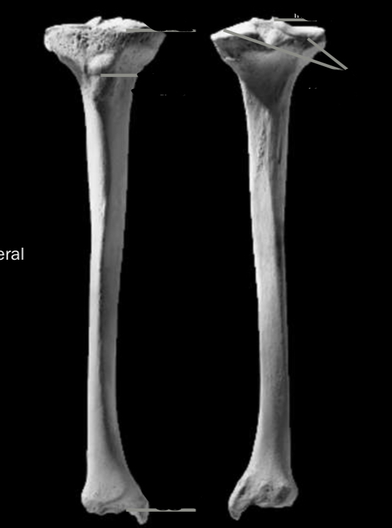 <p>Identify the medial and lateral condyle</p>