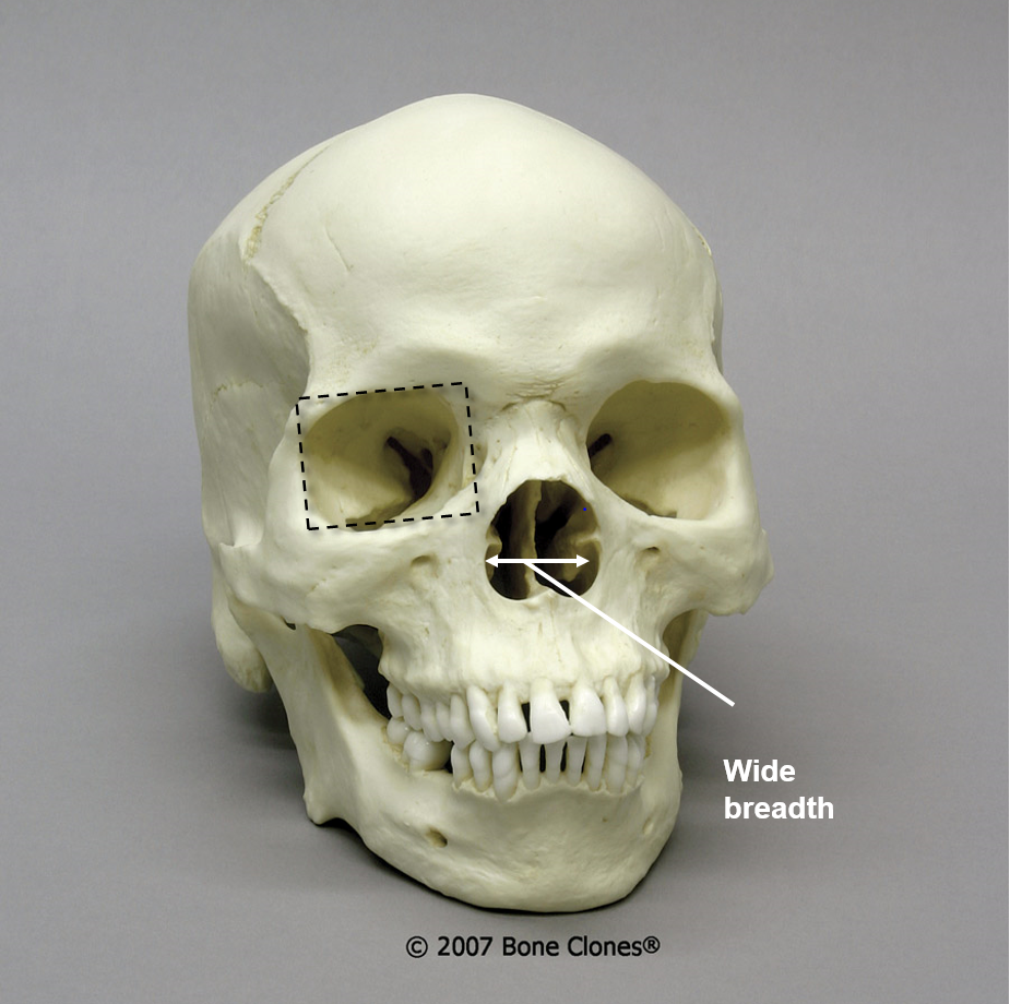 <p>Of what ancestry is this skull?</p>