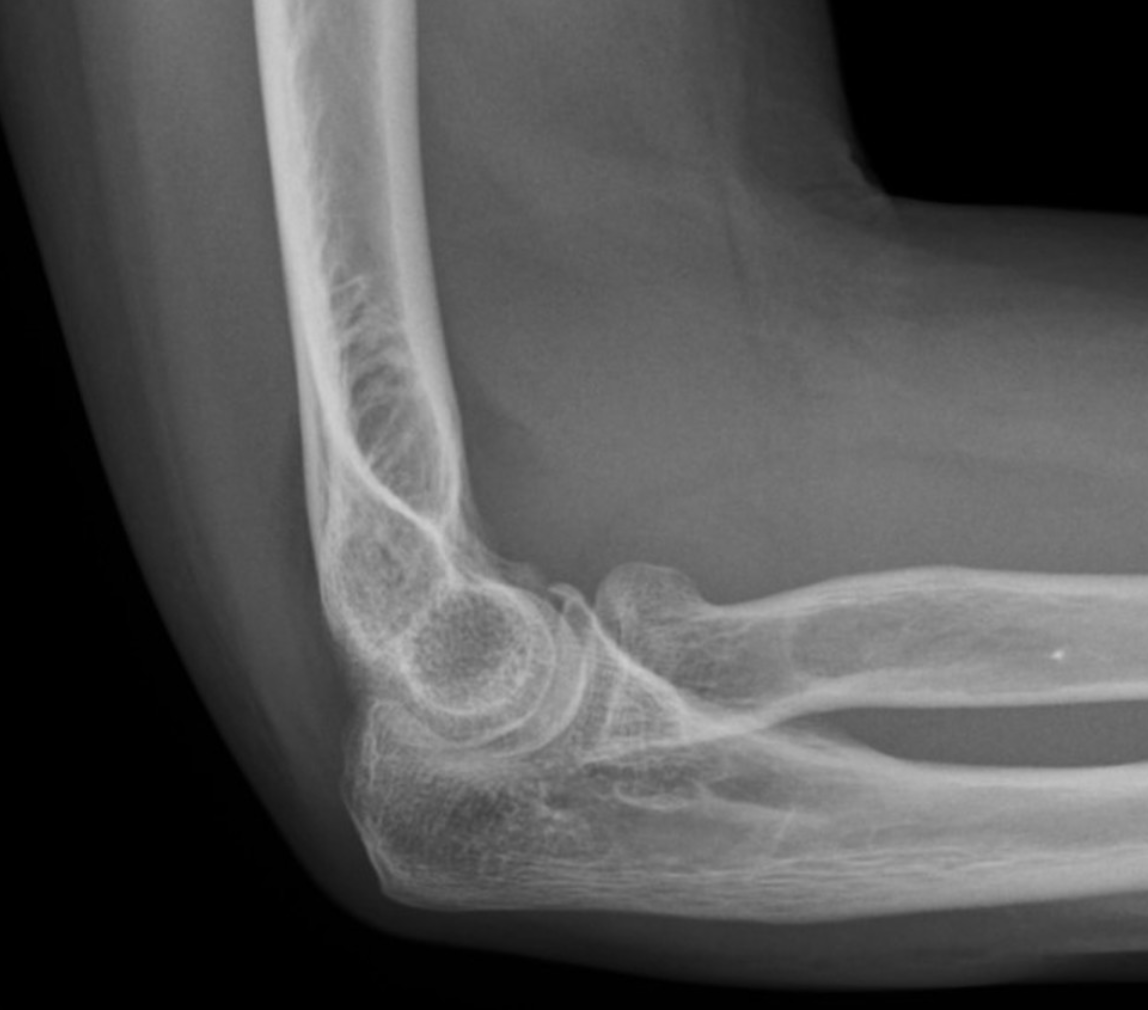 <p><em>If</em> something is indicated on this radiograph, what is it?</p>