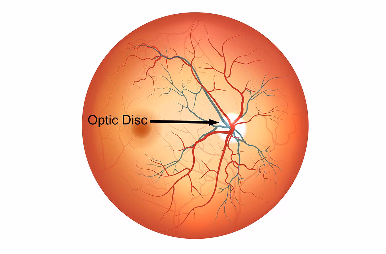 <p>The <strong><em></strong></em>__ is the point on the retina where the optic nerve leaves the eye, creating a blind spot because it lacks photoreceptor cells.</p>