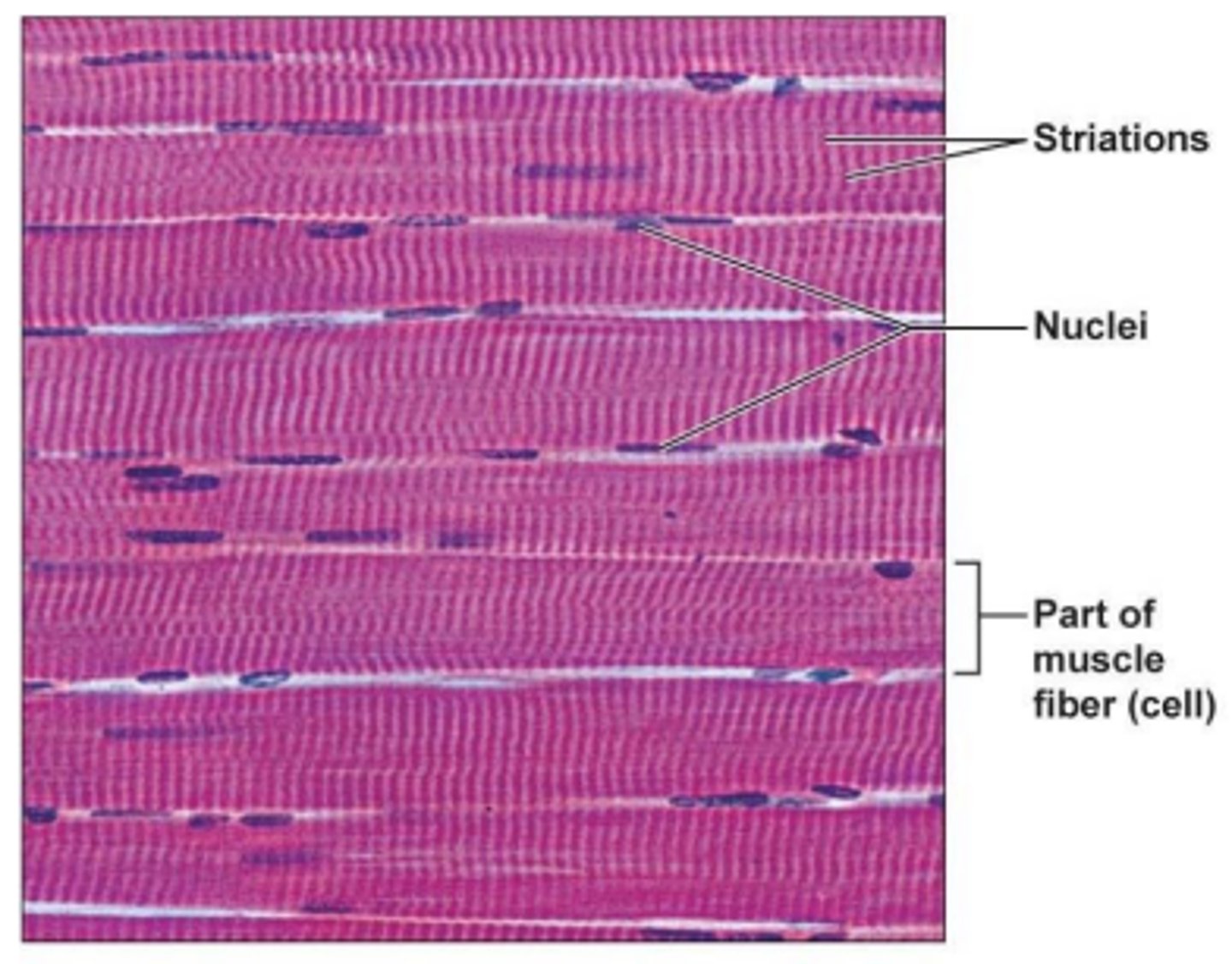 <p>- long cylindrical and multinucleate</p><p>- contains obvious striations</p><p>- poor regeneration</p>