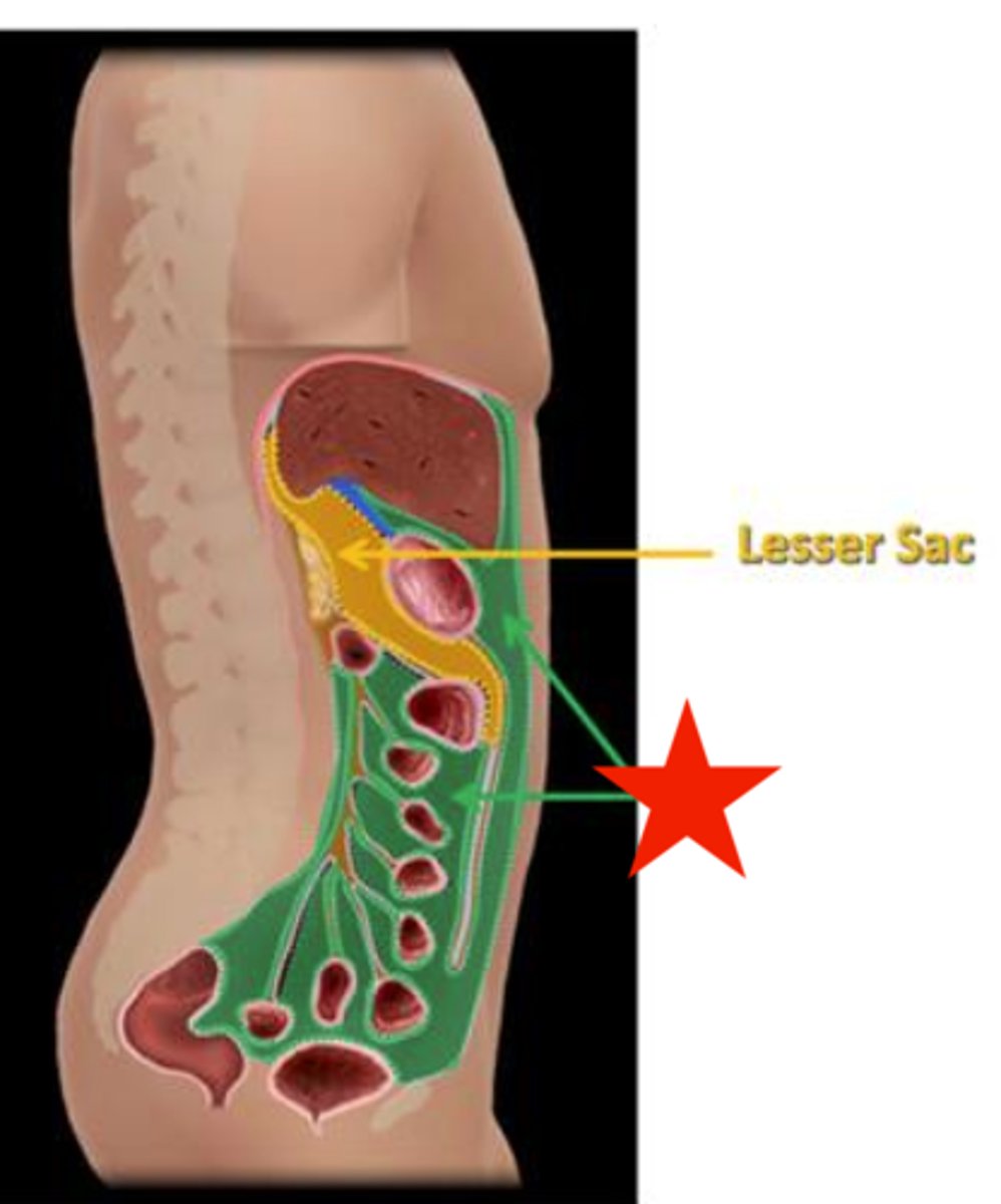 <p>Subhepatic and Subphrenic spaces</p>