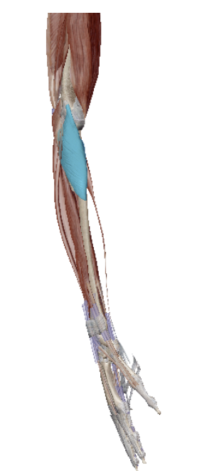 term image