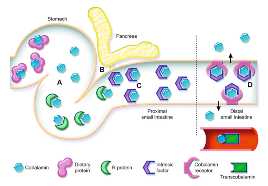 <p>1. <strong><u>chronic </u></strong>distal small intestinal (ileum) disease</p><p>2. surgical removal of ileum</p><p>3. exocrine pancreatic insufficiency</p>