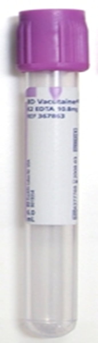 <p>Use sterile technique with a spinal tap needle/stylet,</p><p>Collect in EDTA lavender top tubes for cytology or culture.</p>