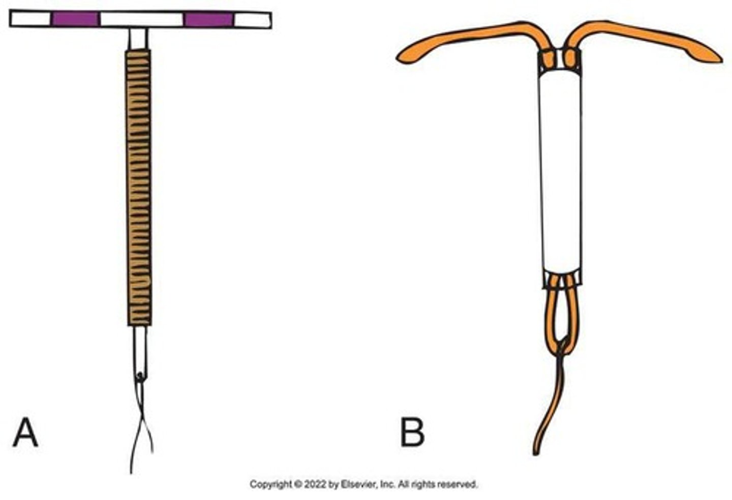 <p>A small, T-shaped device inserted into the uterine cavity to prevent pregnancy.</p>