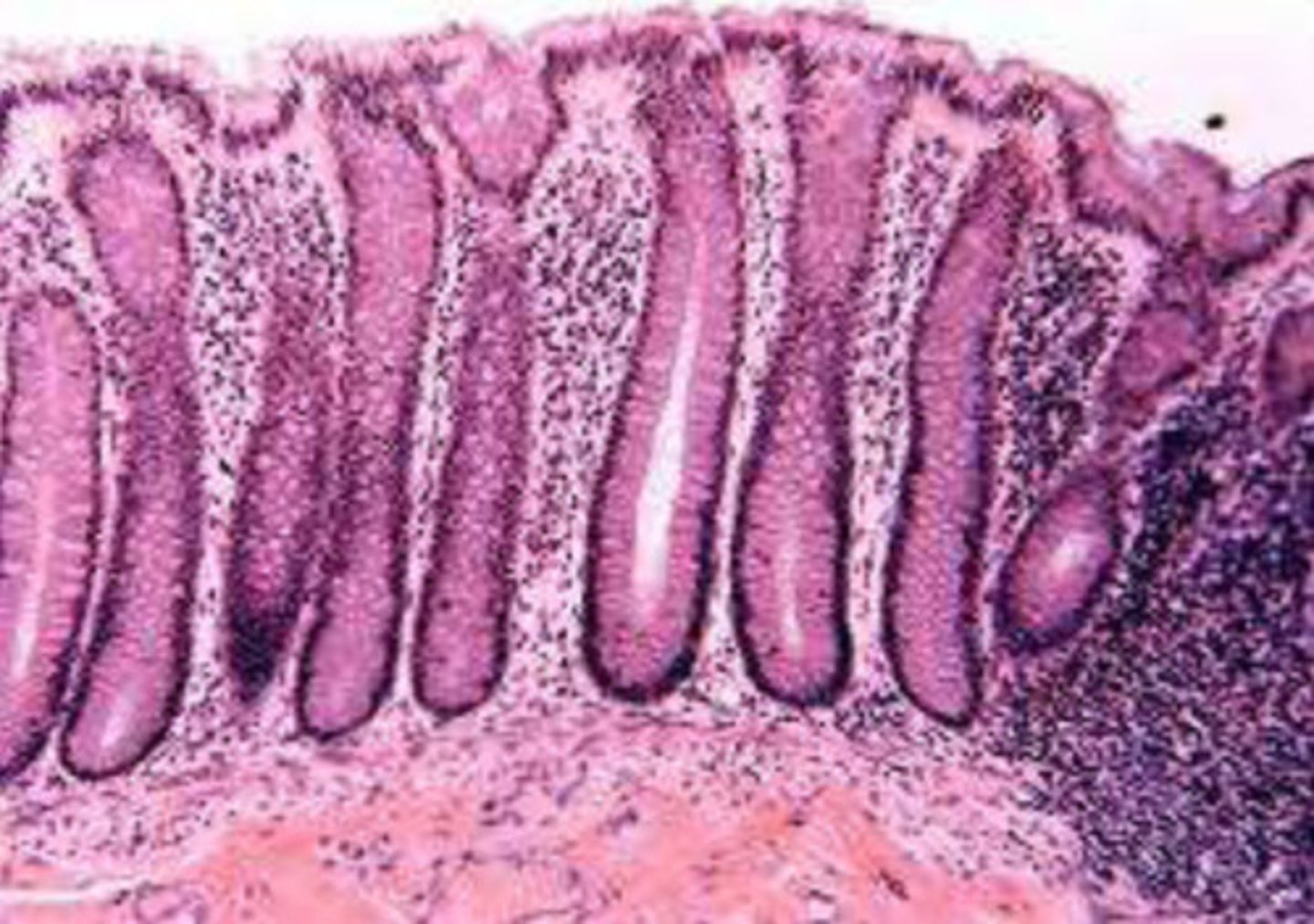 <p>Exocrine:</p><p>- serous glands secrete enzymes</p><p>- mucous glands secrete mucins</p><p>- mixed exocrine glands</p><p>Endocrine:</p><p>- secretes hormones (through CV system)</p>