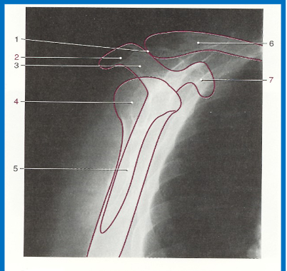 <p>without labeling, this is the anatomy of what kind of x-ray? (projection and body part)</p>