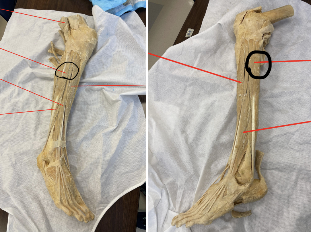 <p>identify + state origin, insertion, action, innervation of marked structure</p>