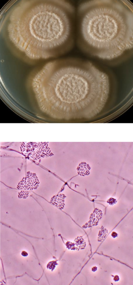 <p>Sarocladium spp</p>