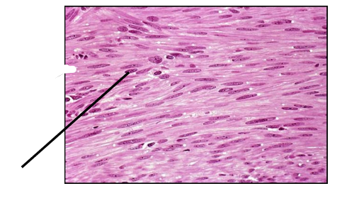 <p>What type of smooth muscle tissue is this?</p>