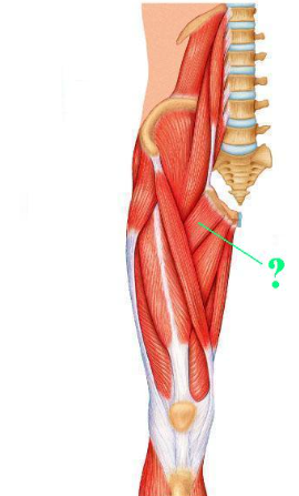 <p><span>Identify the indicated muscle.</span></p>