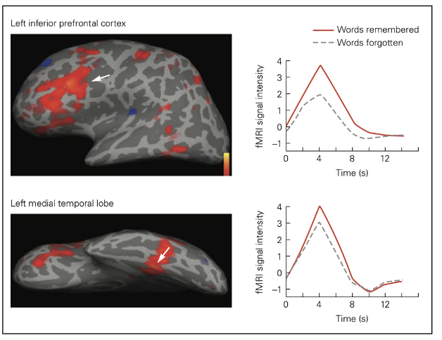 <p>sterkere interactie tussen linker inferieure prefrontale cortex (centraal executief netwerk) & hippocampus bij encoderen → geeft betere kans op onthouden</p>