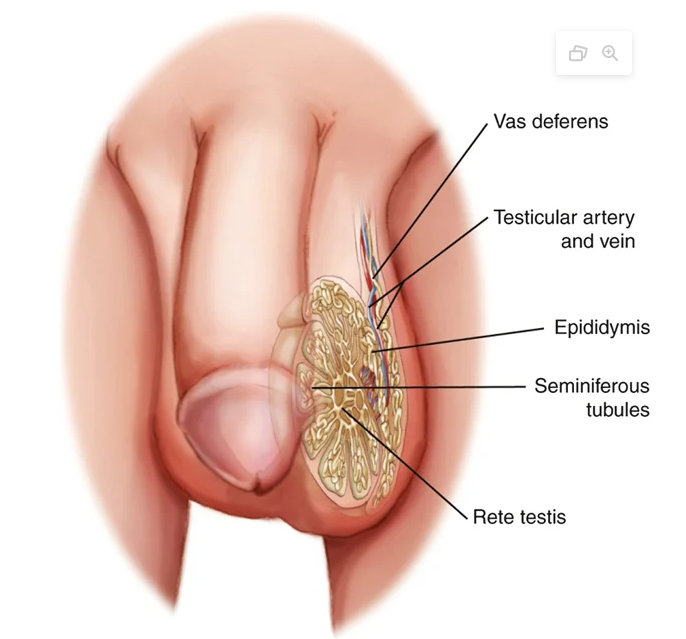 <p><span><span>Production of sperm & testosterone</span></span><span style="line-height: 0px;"><span></span></span></p><ul><li><p class="Paragraph WhiteSpaceCollapse SCXP7108287 BCX0" style="text-align: left;"><span>3.5°F (2°C) lower than core body temperature</span></p></li></ul><p class="Paragraph WhiteSpaceCollapse SCXP7108287 BCX0" style="text-align: left;"><span style="background-color: rgba(0, 0, 0, 0);"><span>Prepuce: Foreskin</span></span></p><p class="Paragraph WhiteSpaceCollapse SCXP7108287 BCX0" style="text-align: left;"><span style="background-color: rgba(0, 0, 0, 0);"><span>Full bladder -> penile erection</span></span></p><p><strong>Epididymis → Vas deferens → Ejaculatory duct → Urethra</strong></p><ul><li><p>Rete Testis: <strong>collect sperm</strong> from the <strong>seminiferous tubules</strong> and <strong>transport them</strong> into the <strong>epididymis</strong> via the <strong>efferent tubules.</strong></p></li><li><p><strong>Epididymis:</strong>.</p><ul><li><p>Functions: <strong>storage, maturation, and transport of sperm.</strong></p></li></ul></li><li><p><strong>Vas deferens (ductus deferens):</strong></p><ul><li><p>Transports sperm <strong>from epididymis to ejaculatory duct.</strong></p></li><li><p>Along with <strong>arteries, veins, and nerves</strong>, forms the <strong>spermatic cord.</strong></p></li><li><p>The spermatic cord ascends through the <strong>external inguinal ring → inguinal canal.</strong></p></li><li><p>Joins the <strong>seminal vesicle</strong> before entering the prostate to form the <strong>ejaculatory duct.</strong></p></li></ul></li><li><p><strong>Ejaculatory duct:</strong></p><ul><li><p>Passes <strong>through the prostate gland</strong> and opens into the <strong>posterior urethra.</strong></p></li></ul></li><li><p><strong>Urethra:</strong></p><ul><li><p>Length: <strong>18–20 cm (7–8 in.)</strong>, from <strong>bladder to meatus.</strong></p></li><li><p>Divided into <strong>three parts:</strong></p><ol><li><p><strong>Posterior</strong></p></li><li><p><strong>Membranous</strong></p></li><li><p><strong>Cavernous (anterior)</strong></p></li></ol></li></ul></li></ul><p><strong>Seminiferous Tubules</strong> </p><ul><li><p>Located <strong>inside each testicle.</strong></p></li><li><p>Consist of <strong>coiled ducts</strong> where <strong>spermatogenesis (sperm production)</strong> occurs.</p></li><li><p><strong>Sperm maturation cycle:</strong> approximately <strong>every 90 days.</strong></p></li></ul><p></p>