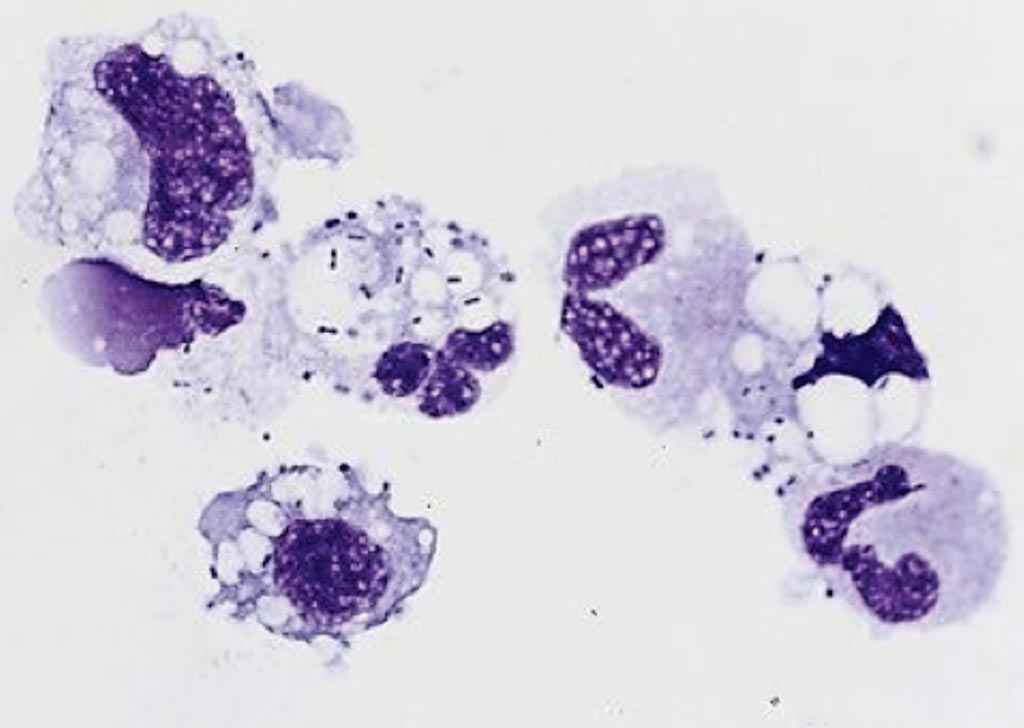 <p>lymphocytes</p>