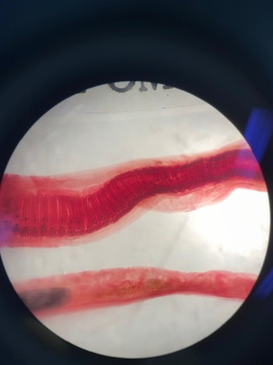 <p>What are the black dotted structures shown here?</p>