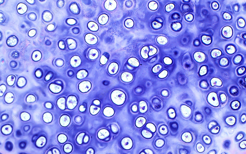 <p>What type of connective tissue is shown in the image?</p>