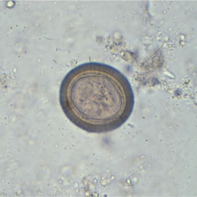 <p>This parasite is found in the skeletal and cardiac muscles of cattle causing pain, and myositis. Please name this parasite.</p>
